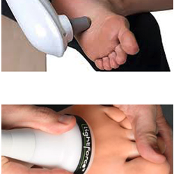 Reliefnow Laser Methods - Plantar Fasciitis