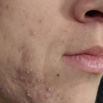 Skin Prophecy - Prior to facial and skin routine - Skin Care Near Me - Santa Barbara, California Skin Prophecy - Prior to facial and skin routine - Skin Care Near Me - Santa Barbara, California