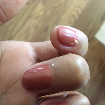 Vn Nails - Bad cuticle removal by manicurist Oanh. - Nail Salons Near Me - Hurst, Texas Vn Nails - Bad cuticle removal by manicurist Oanh. - Nail Salons Near Me - Hurst, Texas