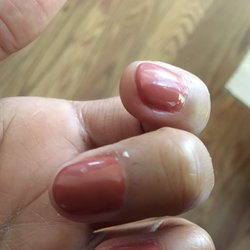 Bad cuticle removal by manicurist Oanh.