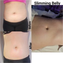 Brazilian Body Sculpting