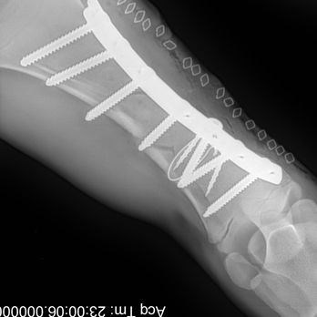 Alpine Veterinary Service - Advanced fracture repairs - Veterinarians Near Me - Billings, Montana Alpine Veterinary Service - Advanced fracture repairs - Veterinarians Near Me - Billings, Montana