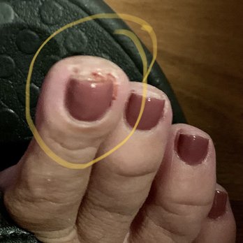 KC Nails & Spa - Cut skin ... dry blood!! - Nail Salons Near Me - La Habra, California KC Nails & Spa - Cut skin ... dry blood!! - Nail Salons Near Me - La Habra, California