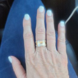 Horrible nails Horrible nails