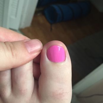 Cindy's Nail Spa - This is what my toe usually looks like. See how far they cut back the other? - Nail Salons Near Me - Atherton, California