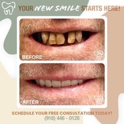 Smile Route Dentures & Implants