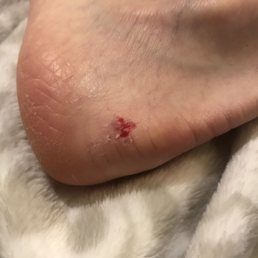 Not the relaxing pedicure I was hoping for after a busy week :(