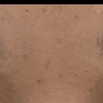 The Beauty Doc - My real eyebrows - Teeth Whitening Near Me - Maspeth, New York
