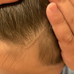 Tooncuts - Cut caused by rough stylist. Would definitely not use her again.