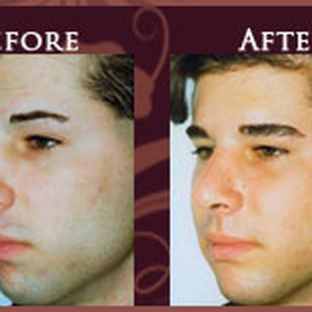 Elliot Heller, MD - Cosmetic Surgeons Near Me - New York, New York