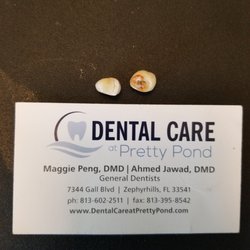 Dental Care at Pretty Pond - Lost Two Teeth and it cost me $839. They will not make it right!