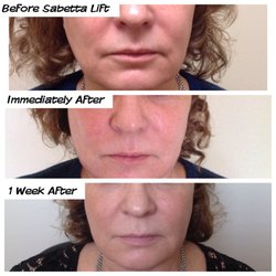 Julia Sabetta, MD