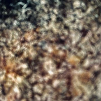 Indoor Science - INFECTED SCALP  SPIRES OF BLACK MOLD IN BODY AND OUTSIDE BODY  EYES - Environmental Testing Near Me
