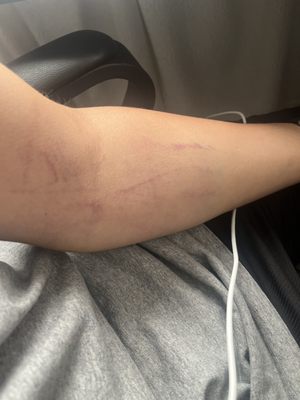 LABCORP - Updated October 2024 - 64 Photos & 101 Reviews - 1703 Termino ...