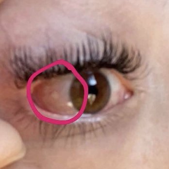 Umi Lash & Beauty - She told me numerous times she couldn't see anything. My eyes are not sensitive and nothing like this has happened to me before. - Eyelash Service Near Me - La Mirada, California Umi Lash & Beauty - She told me numerous times she couldn't see anything. My eyes are not sensitive and nothing like this has happened to me before. - Eyelash Service Near Me - La Mirada, California