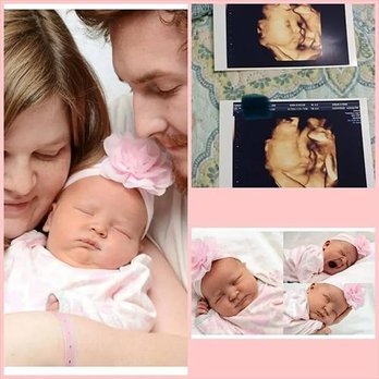 Chubby Cheeks 3D/4D Ultrasound Studio of Amarillo - Ultrasound Imaging Centers Near Me - Amarillo, Texas