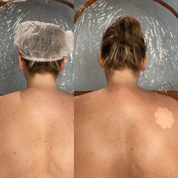 Mobile Sun - Before + After with Norvell Venetian! - Spray Tanning Near Me Mobile Sun - Before + After with Norvell Venetian! - Spray Tanning Near Me