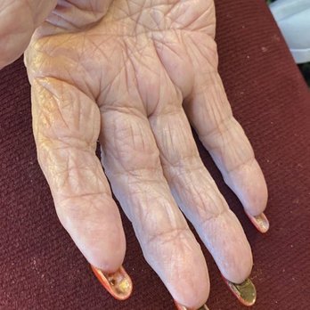 Brookdale Brookhurst - Lack of hygiene assistance during COVID. - Hospice Near Me - Westminster, California