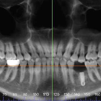 Jose F Lopez, DDS - Oral Surgeons Near Me - Houston, Texas Jose F Lopez, DDS - Oral Surgeons Near Me - Houston, Texas