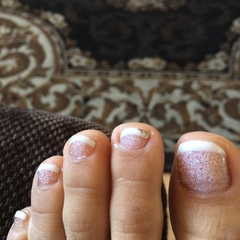 ChiChi Nails & Spa - Before: The French tip pedicure with the weird sparkle (bubble like) polish. - Nail Salons Near Me - Riverside, California