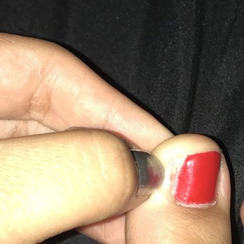 Prism Nails & Spa - My ingrown toenail that is now missing much of the toenail it had before going here. - Nail Salons Near Me - Phoenix, Arizona Prism Nails & Spa - My ingrown toenail that is now missing much of the toenail it had before going here. - Nail Salons Near Me - Phoenix, Arizona
