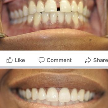 Pure Smiles - # Invisalign - General Dentistry Near Me - Shelby Township, Michigan Pure Smiles - # Invisalign - General Dentistry Near Me - Shelby Township, Michigan