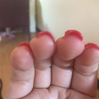 Texas Nails - Not evenly distributed gel on the nail - Nail Salons Near Me - McAllen, Texas Texas Nails - Not evenly distributed gel on the nail - Nail Salons Near Me - McAllen, Texas