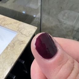 Chipped thumb nail Chipped thumb nail