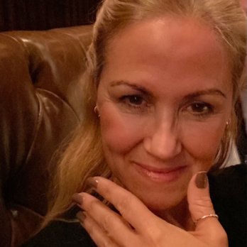 Spa Blue - 45 days later with makeup - Medical Spas Near Me - Orlando, Florida Spa Blue - 45 days later with makeup - Medical Spas Near Me - Orlando, Florida