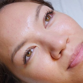 Esthetic Remedies - Skin Care Near Me - Tempe, Arizona Esthetic Remedies - Skin Care Near Me - Tempe, Arizona