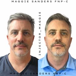Modern Med Aesthetics & Wellness - Relaxed face