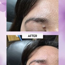 Plush Derma
