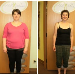 Twin Tigers Acupuncture - 54 lbs in 18 weeks.