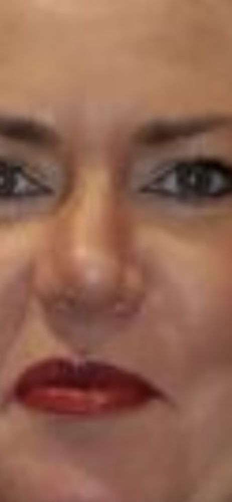 Michael J Yaremchuk, MD