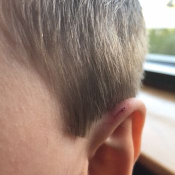 Great Clips - My sons bleeding ear - Hair Salons Near Me - Portage, Indiana Great Clips - My sons bleeding ear - Hair Salons Near Me - Portage, Indiana