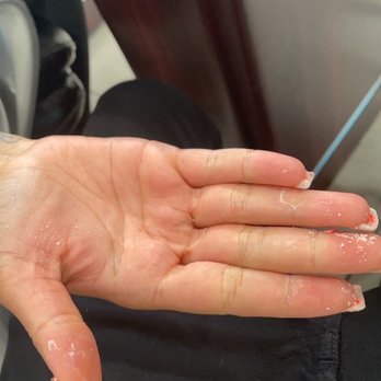 Vanity Nails Lounge - Hands; skin peeling from the acetone. This is expected in order to remove the gel. - Nail Salons Near Me - San Antonio, Texas