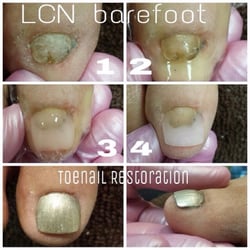 Looks and Company “The Salon” - Vickie now offers LCN Barefoot, which reconstructs the toenail into the perfect nail you can be proud to show.
