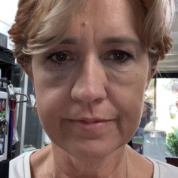 Advanced SkinCare - Concealed - Medical Spas Near Me - Fullerton, California