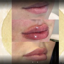 Joli Medispa