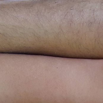 Purely Smooth Skincare - Sugaring- Arms - Skin Care Near Me - Pensacola, Florida Purely Smooth Skincare - Sugaring- Arms - Skin Care Near Me - Pensacola, Florida