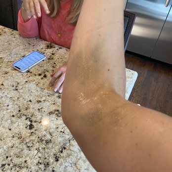 Quest Diagnostics - Bruising and pain - Laboratory Testing Near Me - Allen, Texas Quest Diagnostics - Bruising and pain - Laboratory Testing Near Me - Allen, Texas