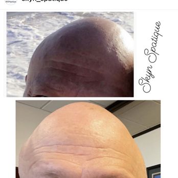 SKYN Spatique Esthetics - Have Melasma? I have solutions. - Skin Care Near Me SKYN Spatique Esthetics - Have Melasma? I have solutions. - Skin Care Near Me