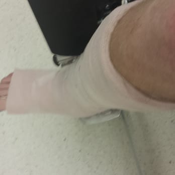 Sky Zone Trampoline Park - Sky zone = broken ankle that needs surgery. Good times? - Trampoline Parks Near Me - Covina, California