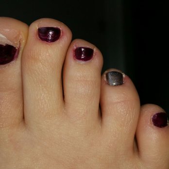 K Nail - Pedicure by manager of K Nails, half of my nail fell off the next morning. The owner and manger told me that ot was my fault. - Nail Salons Near Me - Mc Kees Rocks, Pennsylvania K Nail - Pedicure by manager of K Nails, half of my nail fell off the next morning. The owner and manger told me that ot was my fault. - Nail Salons Near Me - Mc Kees Rocks, Pennsylvania