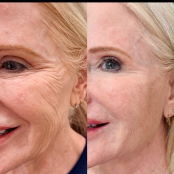 KORÉ Aesthetics - Medical Spas Near Me - Beverly Hills, California KORÉ Aesthetics - Medical Spas Near Me - Beverly Hills, California