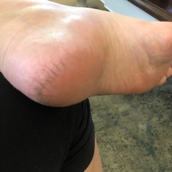 Unique Nails & Spa - Still super cracked heels and still dirty. - Nail Salons Near Me - Temecula, California
