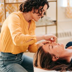 Seneca Falls Acupuncture - Patient getting cosmetic acupuncture at Seneca Falls Acupuncture.