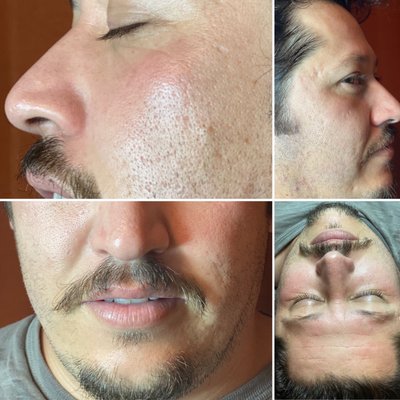 Mirame Skin Treatments by null