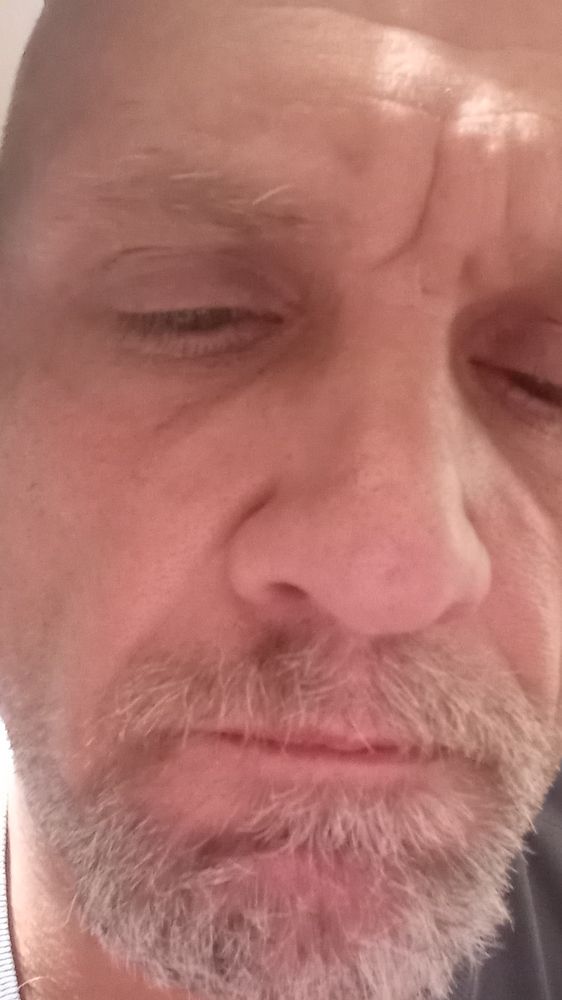 Slide of ANO Remodeling