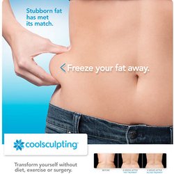Gwen Abeles, MD - Abeles Dermatology Aesthetic & Laser Arts - Coolsculpting is a great non-invasive way to reduce fat in many areas of the body including the neck, love handles, stomach and back.